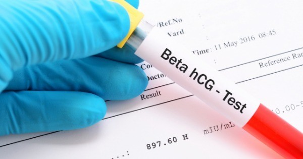 Como Entender O Resultado Do Exame Beta Hcg Guia Médico Brasil 