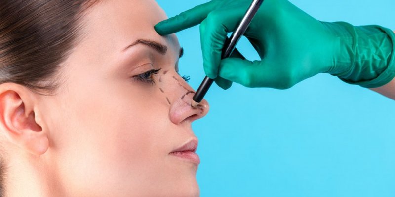 Rinoplastia O nariz de Cleópatra